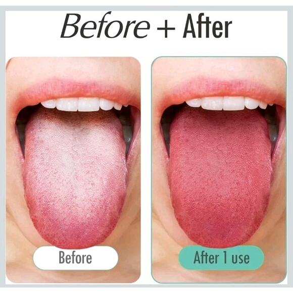 4 Pack Wipe Tongue Fresh Tongue Scraper 100% Stainless Steel Tongue s30 b1 - Picture 4 of 7